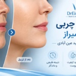 بهترین دکتر تزریق چربی در شیراز - دکتر وحید عین آبادی