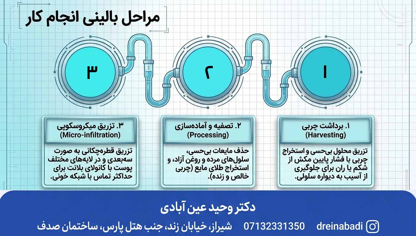 اینفوگرافیک مراحل و روند عمل زیبایی تزریق چربی