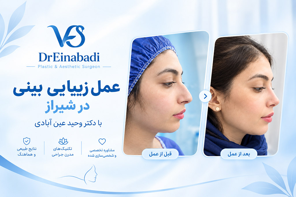 عمل زیبایی بینی در شیراز با دکتر وحید عین آبادی